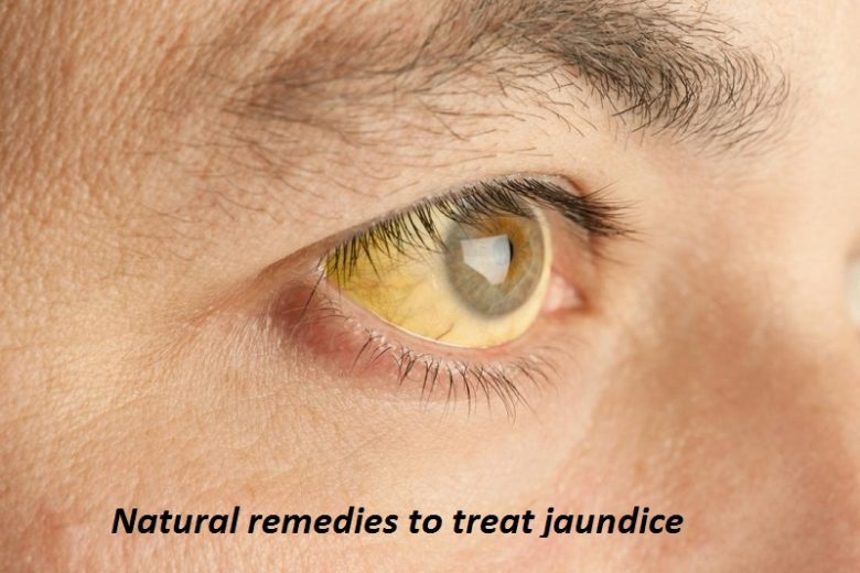 9 Known and favorable natural remedies to treat jaundice