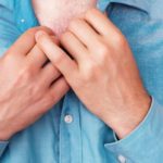 Hyperhidrosis disease and its impact on our self-esteem